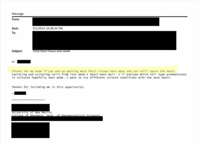 Image via Abortion on Trial University of New Mexico e-mails show repeated demand for aborted baby brains and hearts image