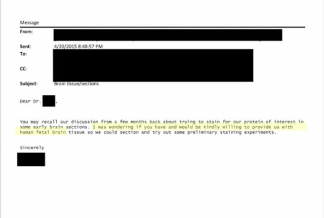 University of New Mexico e-mails show repeated demand for aborted baby brains and hearts image