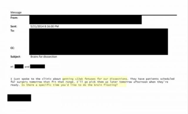 Image via Abortion on Trial University of New Mexico e-mails show repeated demand for aborted baby brains and hearts image