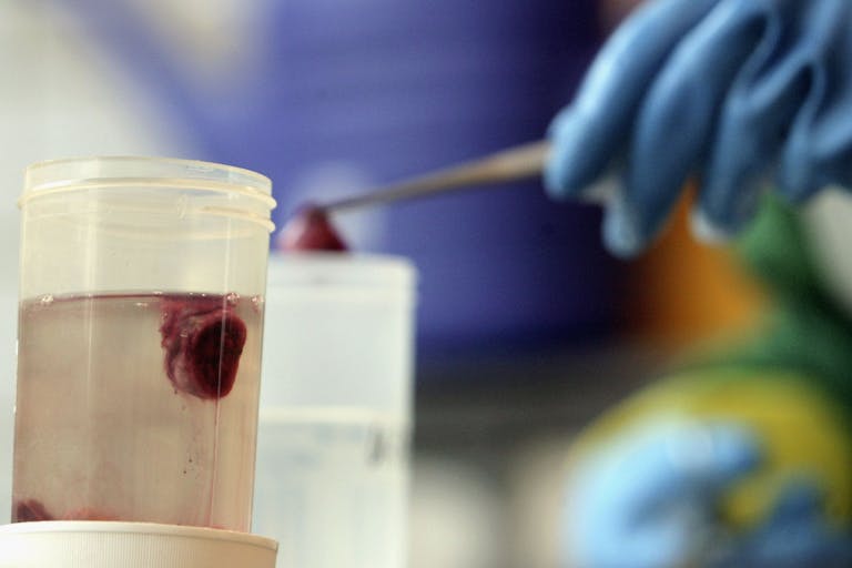 fetal tissue, university of new mexico