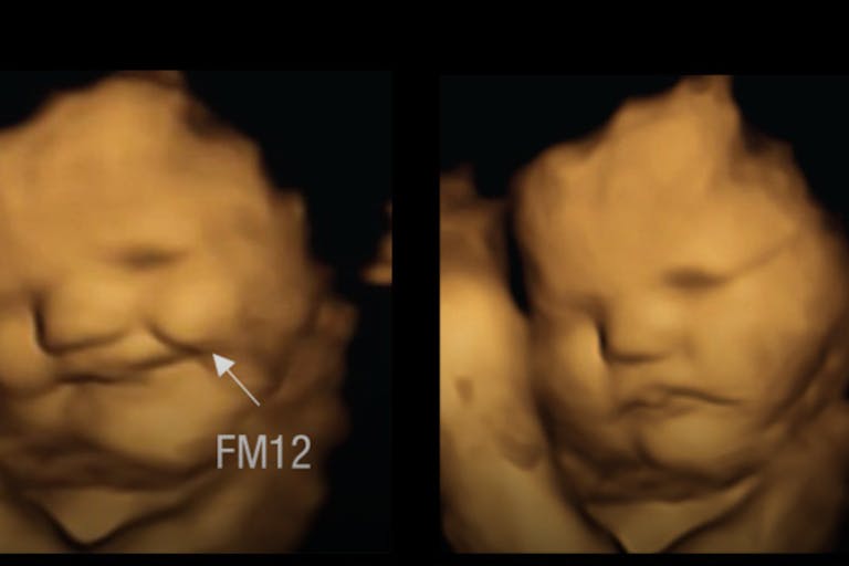 preborn