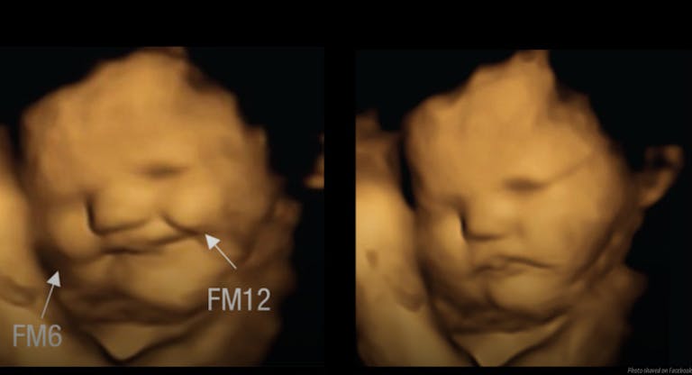 preborn