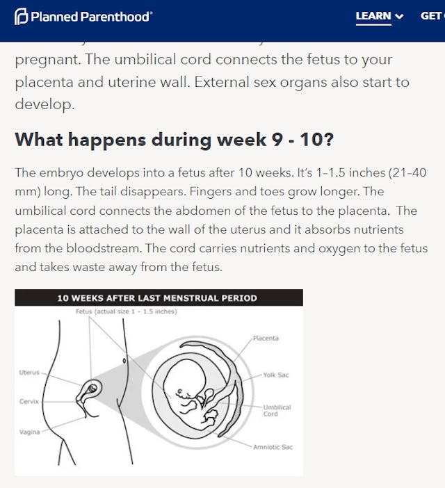 Planned Parenthood fetal development 9 to 10 weeks accessed 09172022 Image: Planned Parenthood fetal development 9 to 10 weeks accessed 09172022