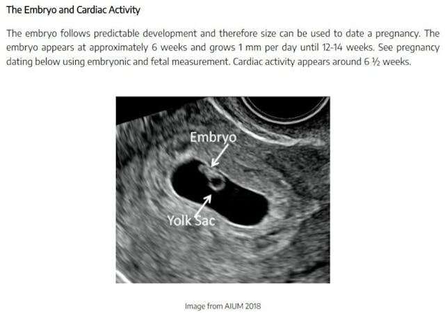 Image: Embryo has cardiac activity by 6 weeks (TEACH abortion training curriculum, 2022)