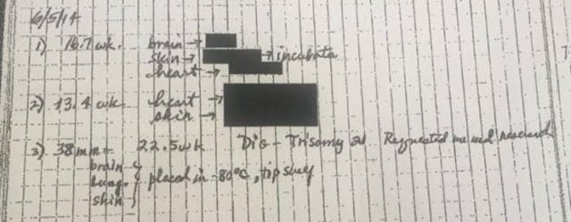 BREAKING: New Mexico AG allowing criminal claims of baby brain, heart, and skin harvesting to expire image