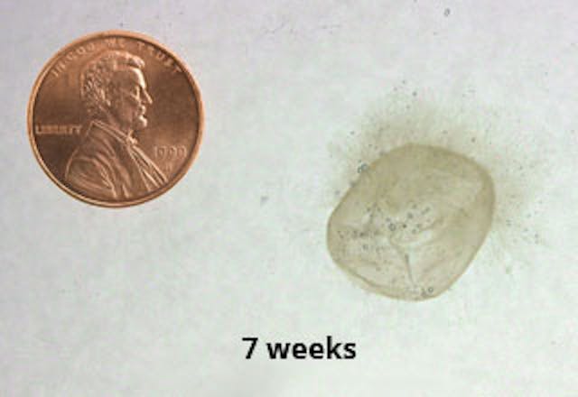 Here’s an abortion facility’s fake drawing of a baby at nine weeks compared to the reality image