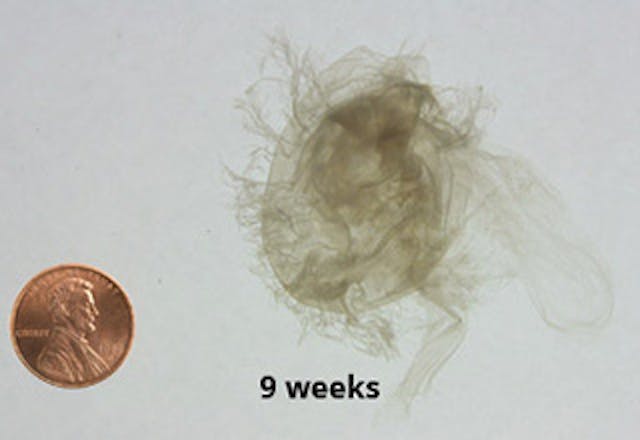 Here’s an abortion facility’s fake drawing of a baby at nine weeks compared to the reality image