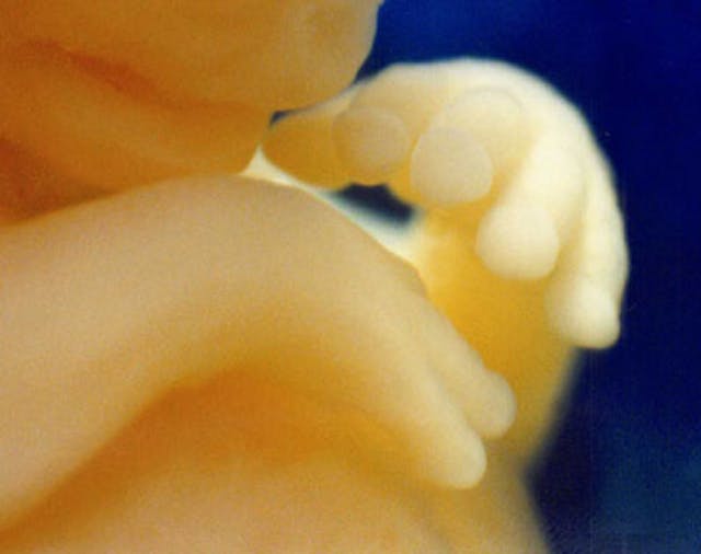 Here’s an abortion facility’s fake drawing of a baby at nine weeks compared to the reality image