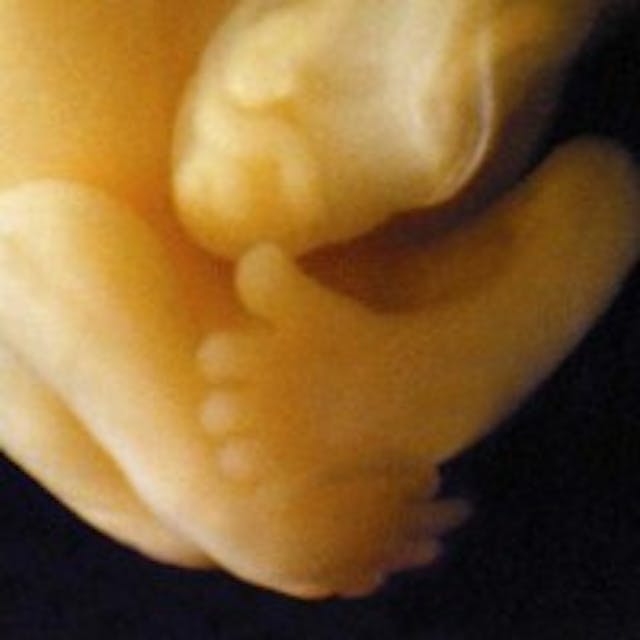 Here’s an abortion facility’s fake drawing of a baby at nine weeks compared to the reality image