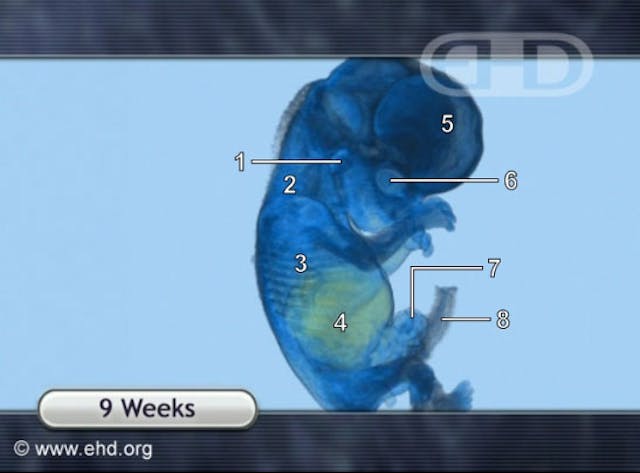 MRI image (ehd.org)