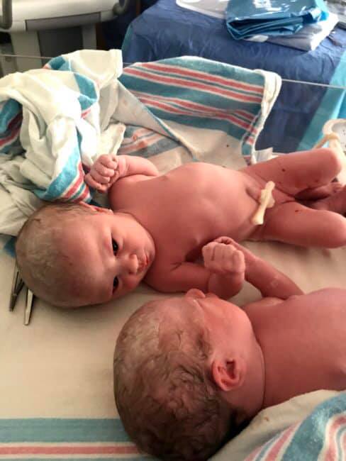 Ada and Billie after birth. Photo via Facebook.