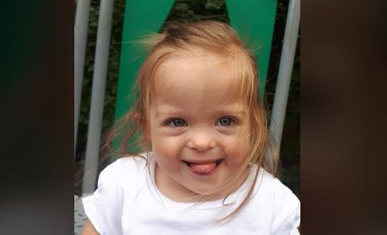 betsy down syndrome