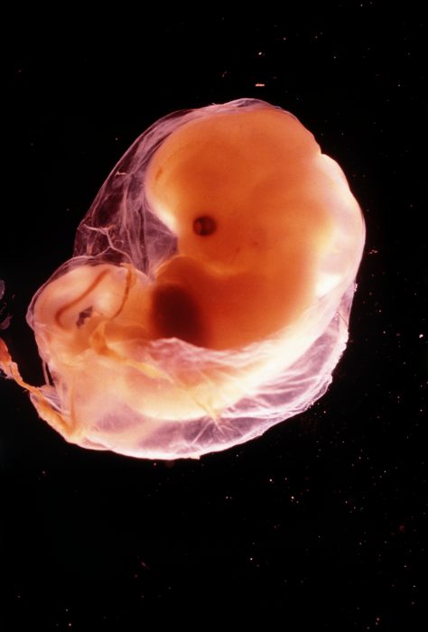 Amazing photos of preborn babies in the womb show that life begins at fertilization image