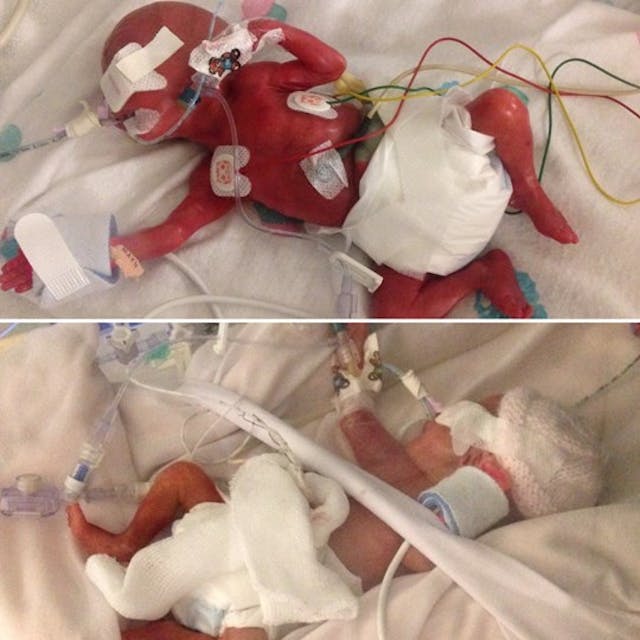 Imogen and Annabelle Photo via Just Giving fundraising page.