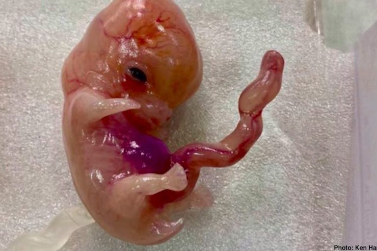 preborn baby ken ham facebook model