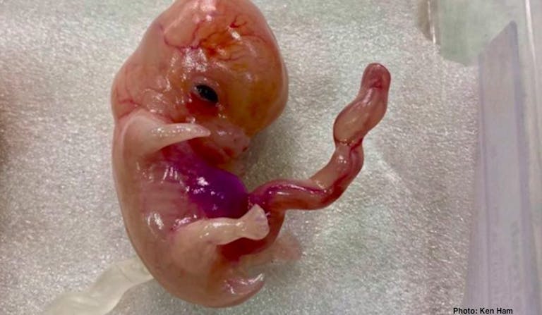 preborn baby ken ham facebook model