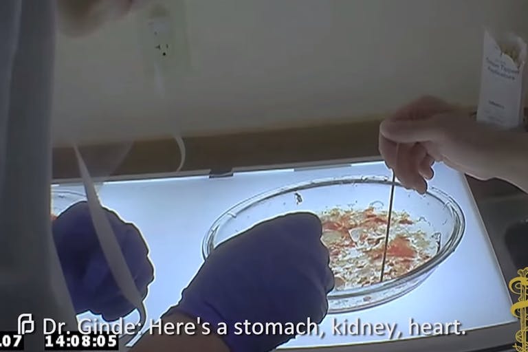 heart-kidney-liven-Planned-Parenthood