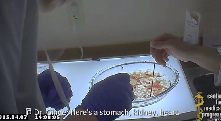 heart-kidney-liven-Planned-Parenthood