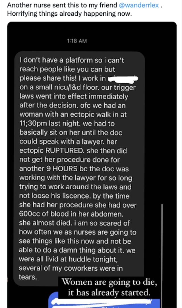 Even Planned Parenthood knows ectopic pregnancy treatment isn’t abortion image