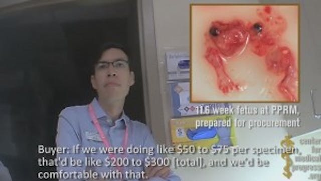 Planned-Parenthood-fetal-parts4