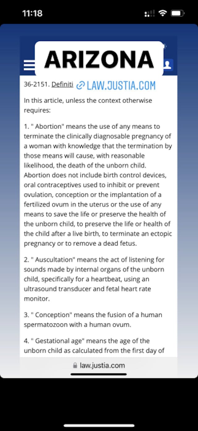 FACT: Treatments for miscarriage and ectopic pregnancy are legal in every state image