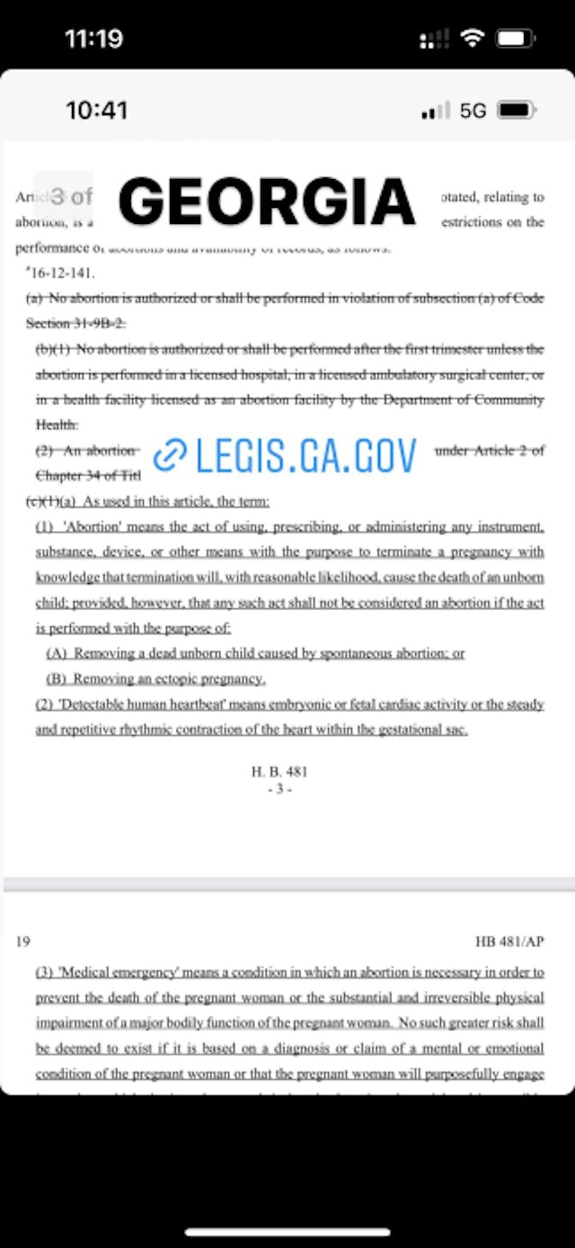 FACT: Treatments for miscarriage and ectopic pregnancy are legal in every state image