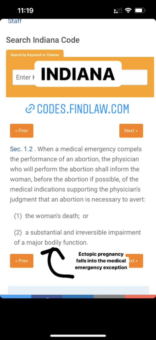 FACT: Treatments for miscarriage and ectopic pregnancy are legal in every state image