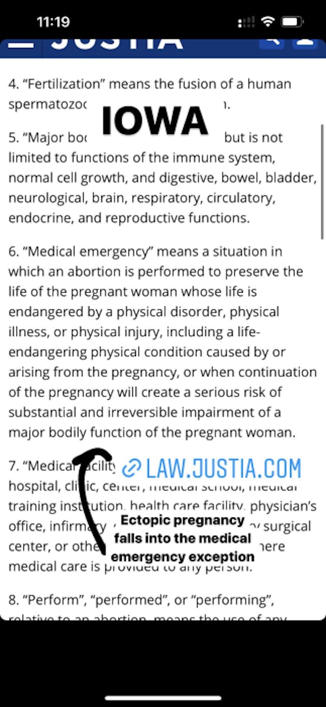 FACT: Treatments for miscarriage and ectopic pregnancy are legal in every state image