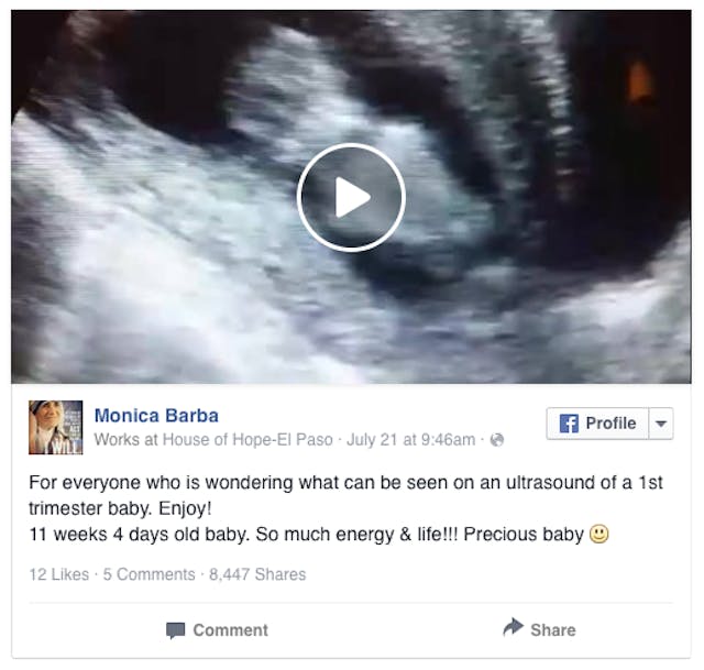 ultrasound video