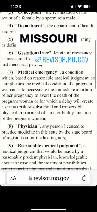 FACT: Treatments for miscarriage and ectopic pregnancy are legal in every state image