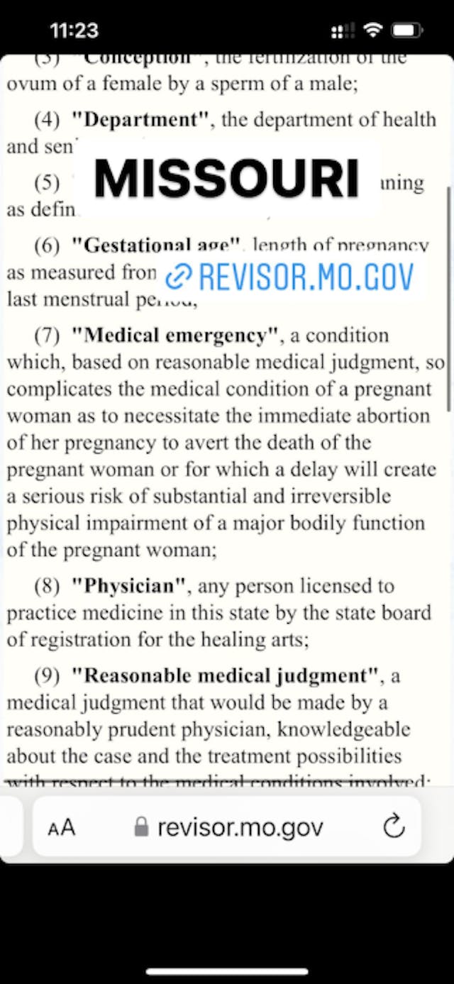 FACT: Treatments for miscarriage and ectopic pregnancy are legal in every state image
