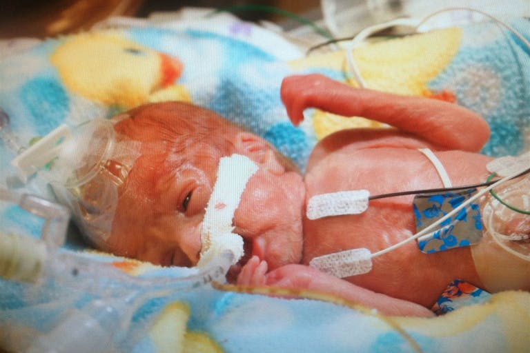 photo_1_a69b7de0fda817371d2338773b64d379.today-inline-large2x