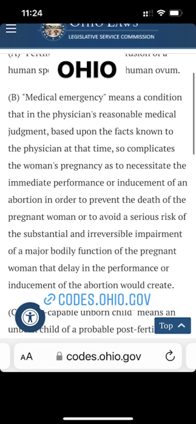FACT: Treatments for miscarriage and ectopic pregnancy are legal in every state image