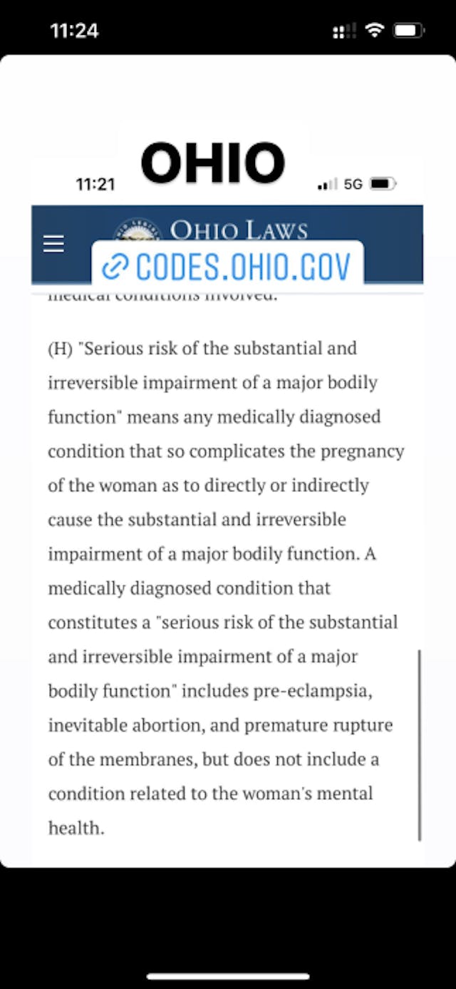 FACT: Treatments for miscarriage and ectopic pregnancy are legal in every state image