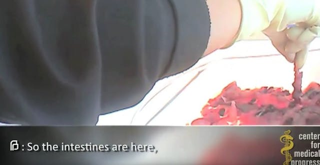 planned-parenthood-intestines