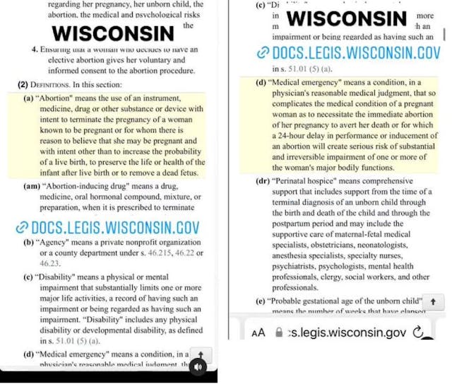 FACT: Treatments for miscarriage and ectopic pregnancy are legal in every state image