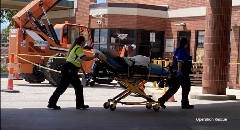 botched abortion