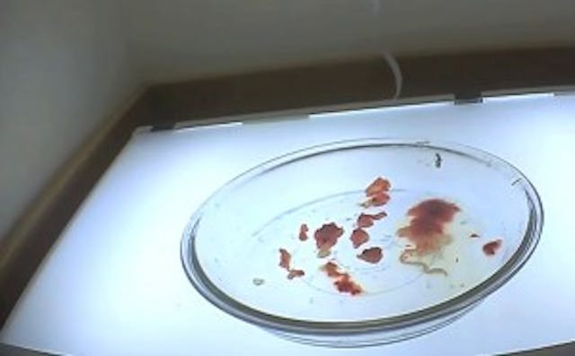 planned-parenthood-aborted-baby-parts