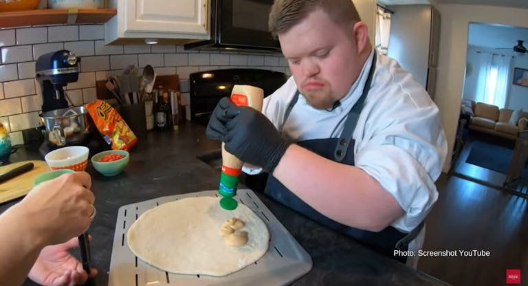 down syndrome (5)