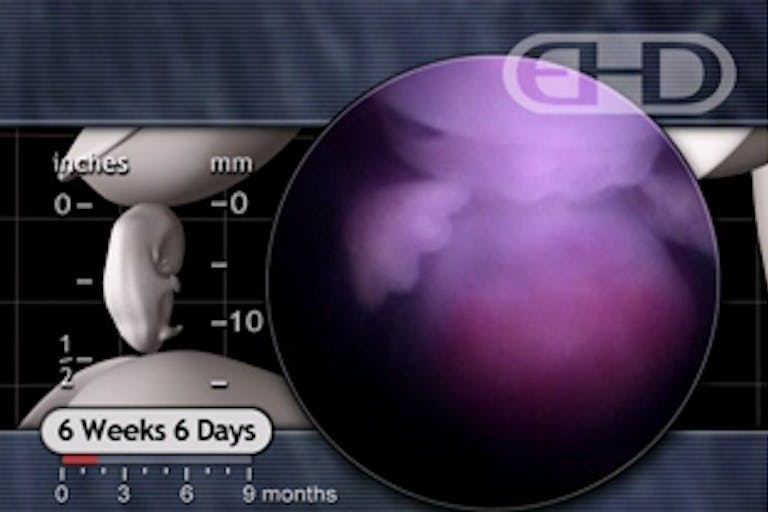 6 week old baby, fetus, embryo