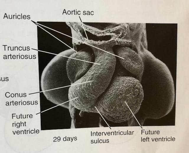 Pro-abortion authors are still lying about prenatal heartbeats. Here’s the truth. image