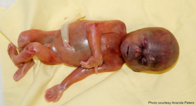 Photo courtesy Ananda Peters Photo courtesy Ananda Peters