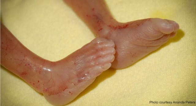 Photo courtesy Ananda Peters Photo courtesy Ananda Peters