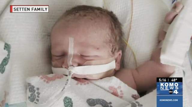 Baby Oliver in a screenshot from Komo News video.