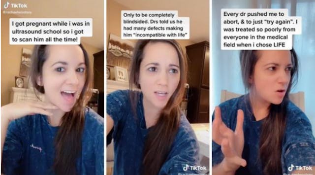 Photo Tiktok rachaelwoolsey prenatal diagnosis