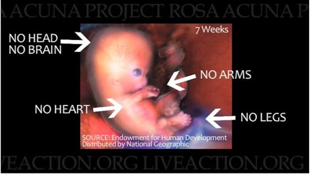 Planned Parenthood’s deception on fetal development countered by ‘Baby Olivia’ image