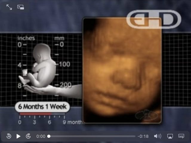 The humanity of babies in the third trimester is undeniable, yet it’s still legal to abort them image