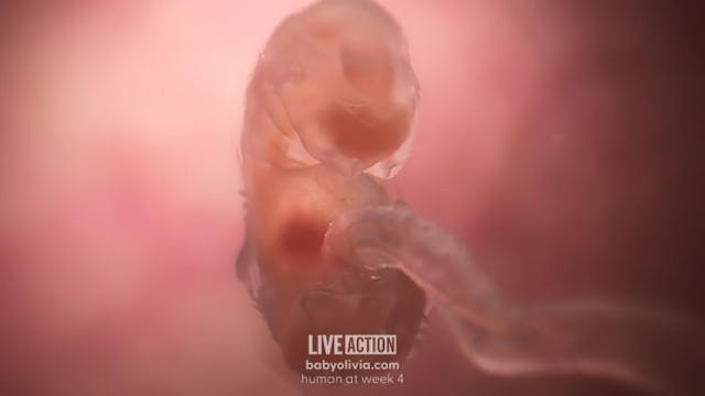 The abortion pill kills living human beings with beating hearts image