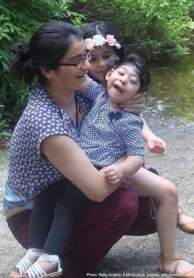 Photo: Baby Angela: A Miraculous Journey with Anencephaly Photo: Baby Angela: A Miraculous Journey with Anencephaly