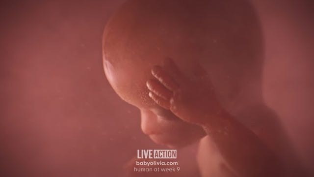 Nine weeks post-fertilization (11 weeks gestation) The abortion industry depicts preborn children as ‘dots.’ Here’s the truth. image